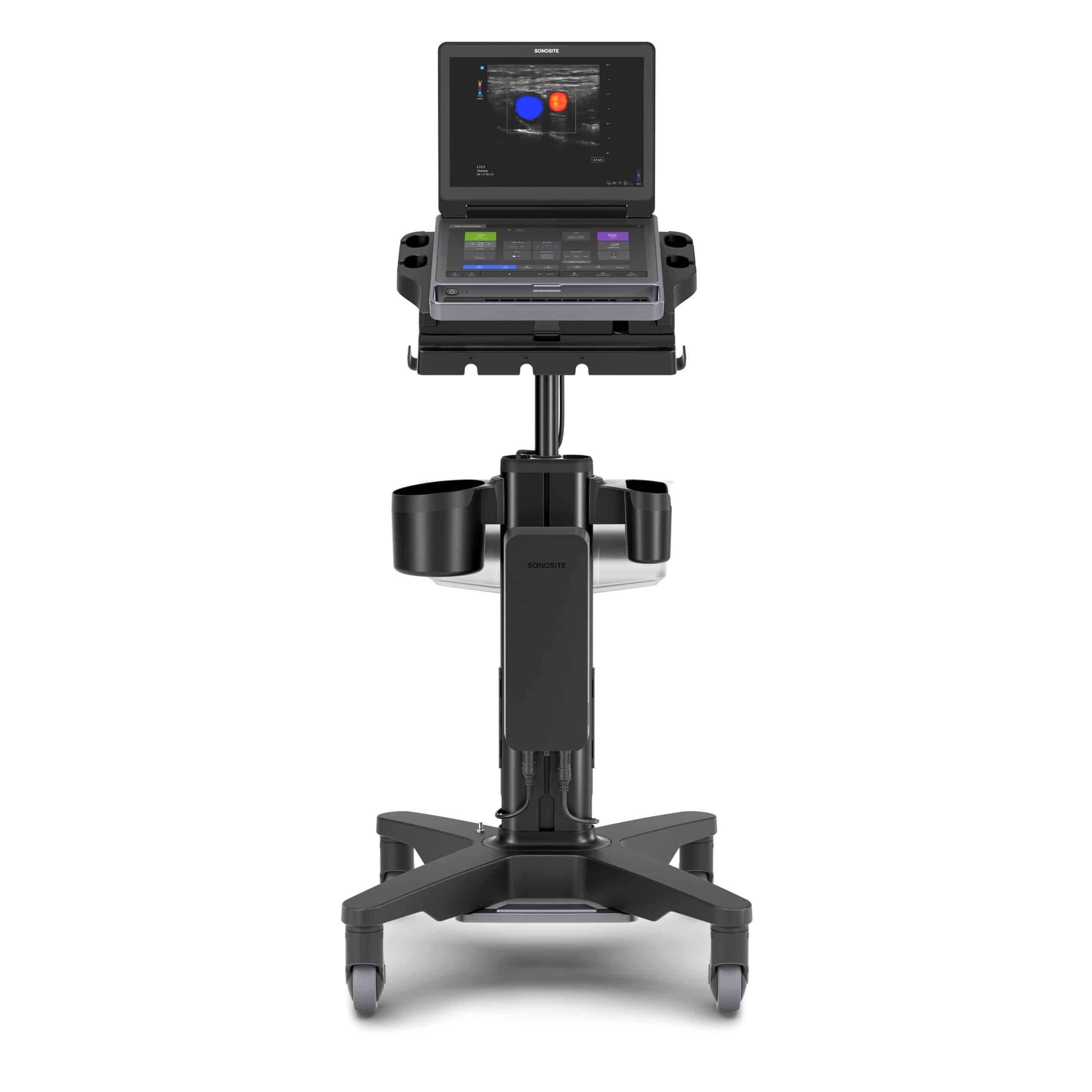 Sonosite MT_Front